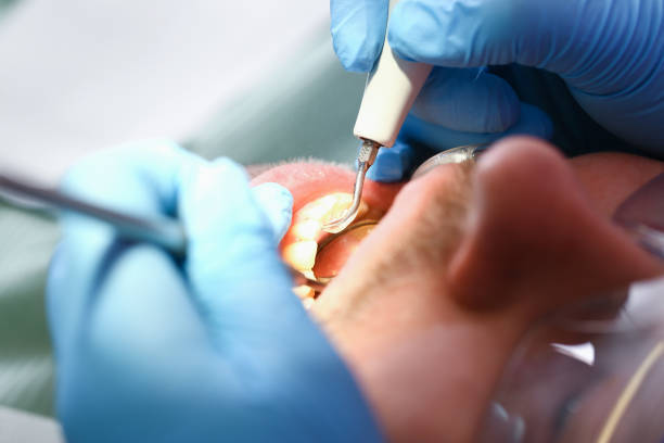 Best Emergency Gum Pain Relief  in Itasca, TX