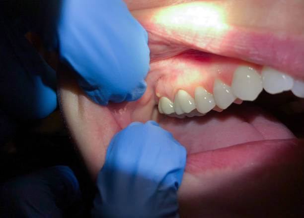 Urgent Tooth Repair